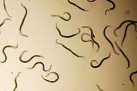 pinworms of the human body
