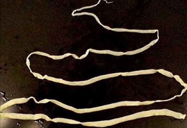 tapeworm of the human body