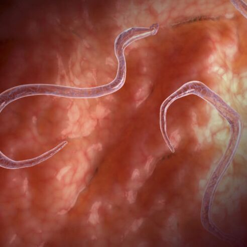 Parasites in the intestines