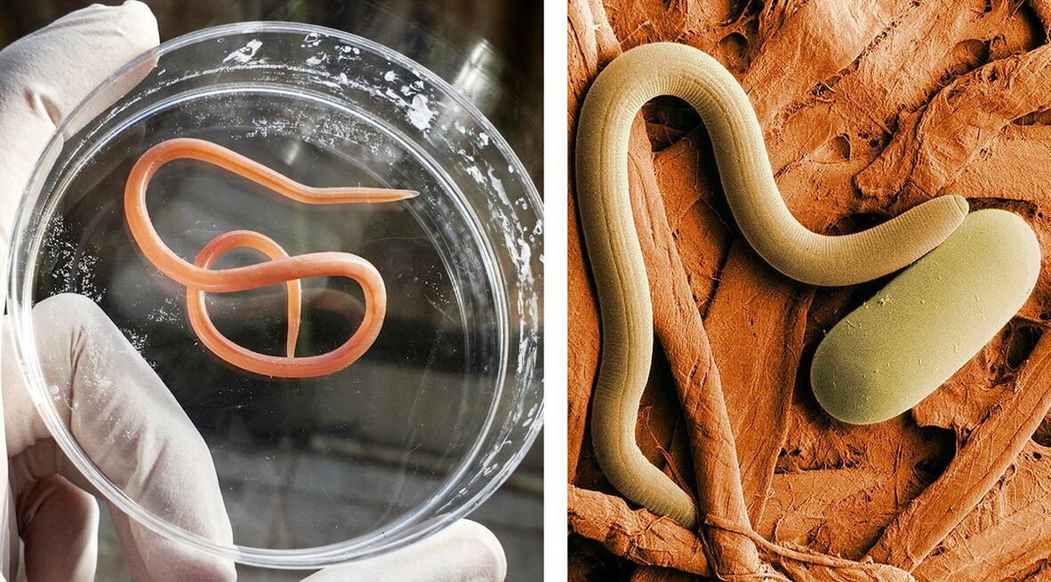 parasites in the human body