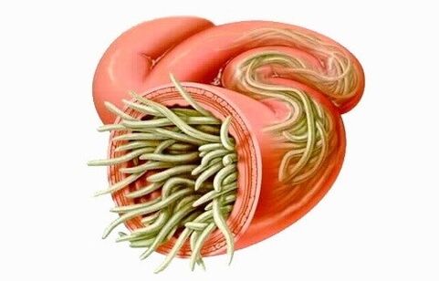 Worms are parasites in the human intestine.