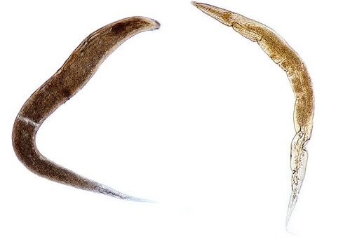 human pinworm parasites