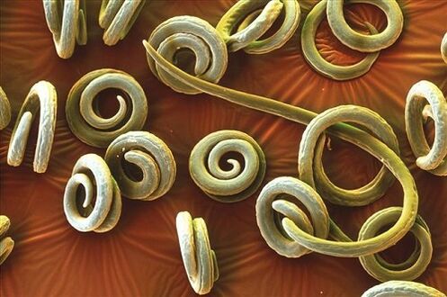 human priquinella parasites