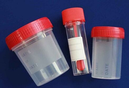 parasite testing vials