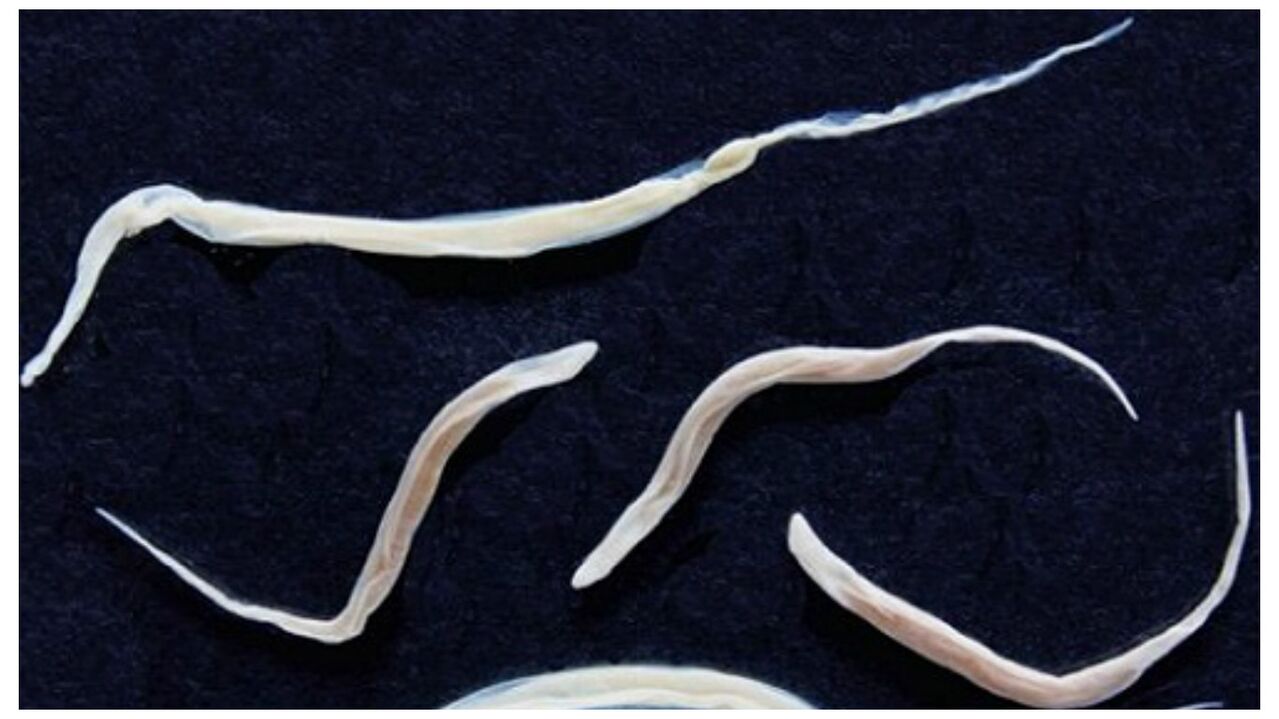 Pinworms are common parasites that belong to the group of helminths.